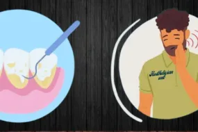 How Long Until a Tooth Infection Kills You?