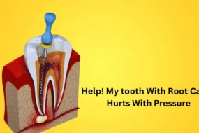 Help! My tooth With Root Canal Hurts With Pressure